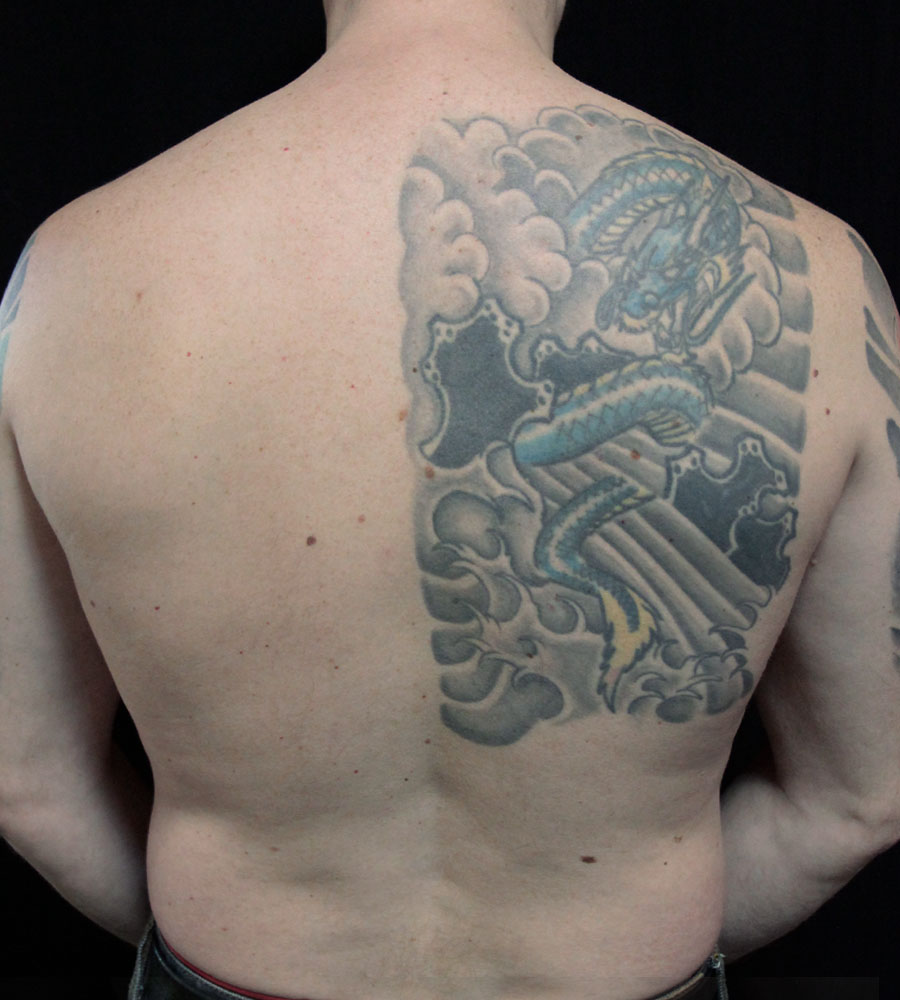 vue du dos avec l'ancien tatouage, avant le nouveau projet